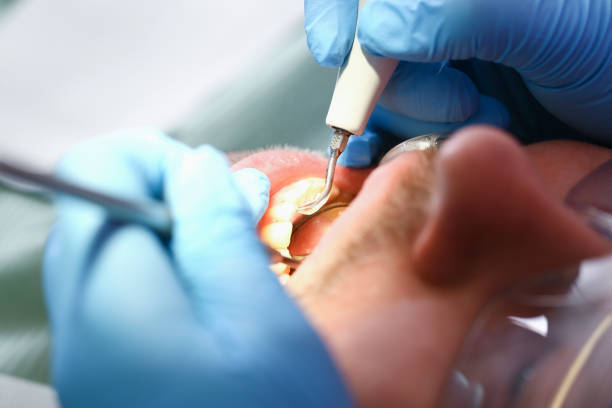 Best Emergency Gum Pain Relief  in Mcgraw, NY