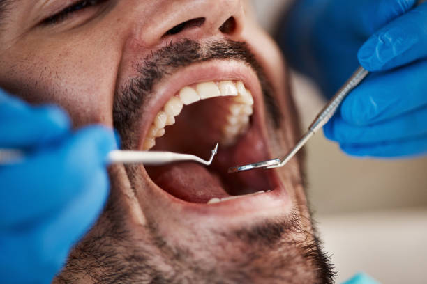 Best Emergency Tooth Extraction  in Mcgraw, NY