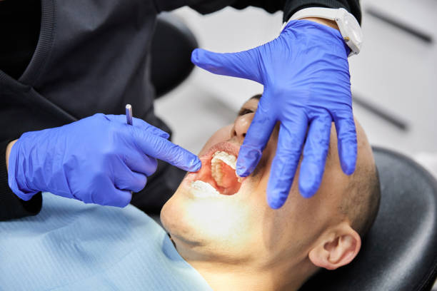 Best Root Canal Emergency Dentist  in Mcgraw, NY