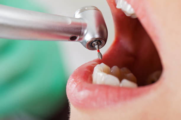 Best Dentist for Tooth Abscess  in Mcgraw, NY